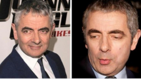 Rowan Atkinson a 29 ans de plus que sa petite amie Louise – Tenez-vous bien quand vous verrez à quoi ressemble l’amour de la star maintenant